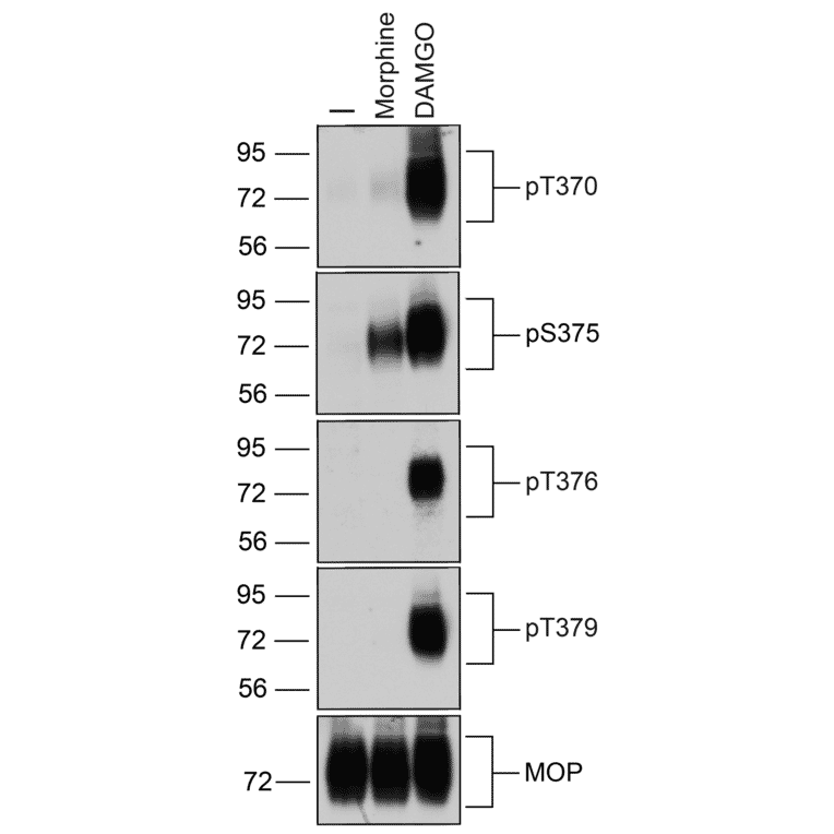 Western blot - Anti-Mu Opioid Receptor (phospho Ser375) Antibody (A334520) - Antibodies.com