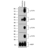 Western blot - Anti-Mu Opioid Receptor (phospho Ser375) Antibody (A334520) - Antibodies.com