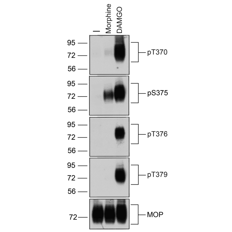 Western blot - Anti-Mu Opioid Receptor (phospho Thr370) Antibody (A334521) - Antibodies.com