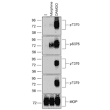 Western blot - Anti-Mu Opioid Receptor (phospho Thr370) Antibody (A334521) - Antibodies.com