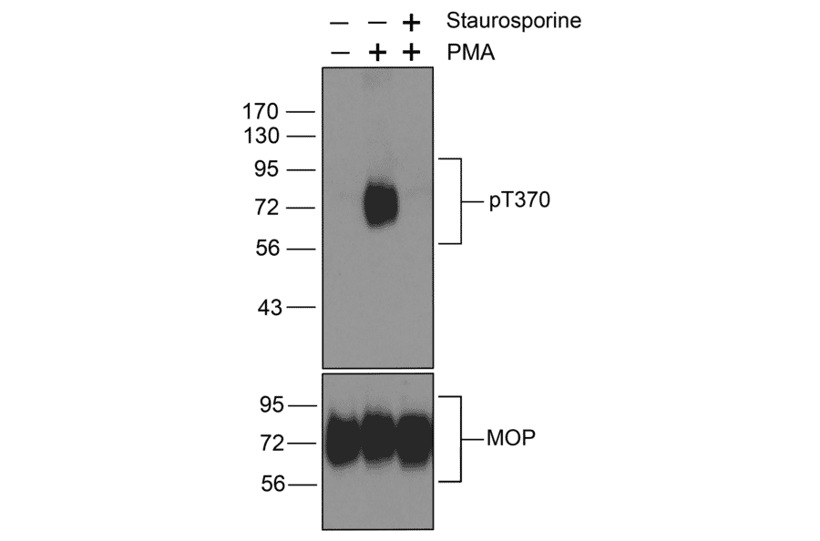 Western blot - Anti-Mu Opioid Receptor (phospho Thr370) Antibody (A334521) - Antibodies.com