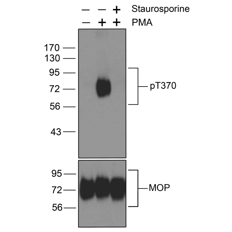 Western blot - Anti-Mu Opioid Receptor (phospho Thr370) Antibody (A334521) - Antibodies.com