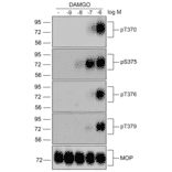 Western blot - Anti-Mu Opioid Receptor (phospho Thr376) Antibody (A334522) - Antibodies.com
