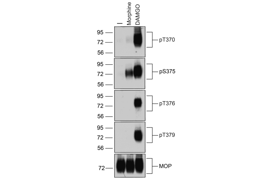 Western blot - Anti-Mu Opioid Receptor (phospho Thr376) Antibody (A334522) - Antibodies.com