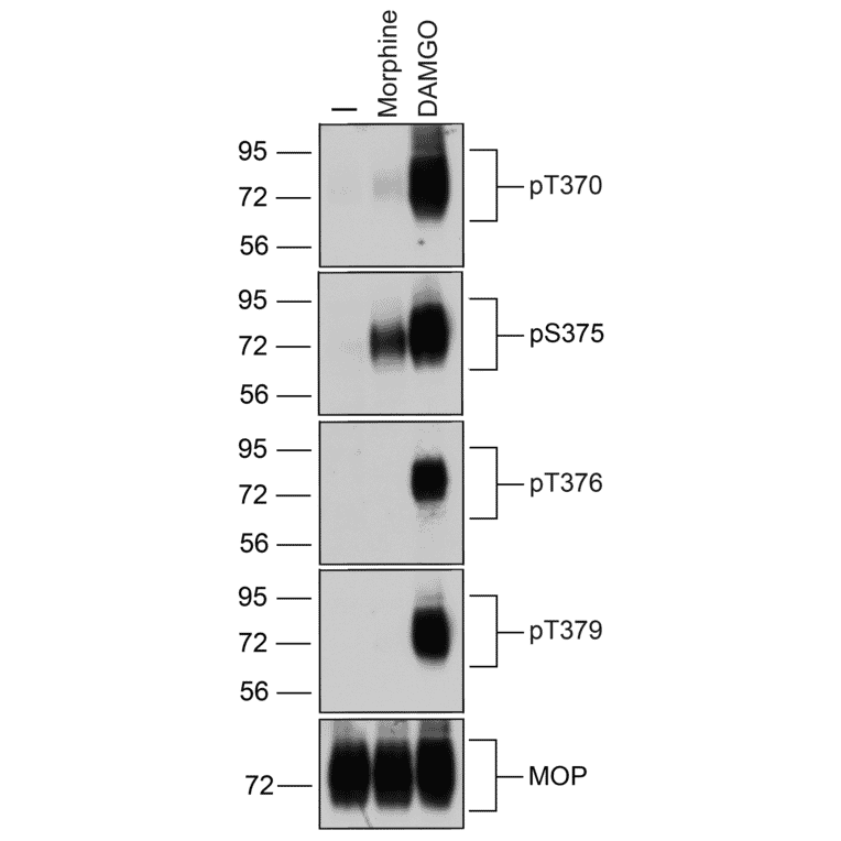 Western blot - Anti-Mu Opioid Receptor (phospho Thr376) Antibody (A334522) - Antibodies.com