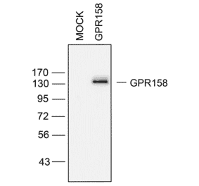 Western blot - Anti-GPR158/mGlyR Antibody (A334524) - Antibodies.com