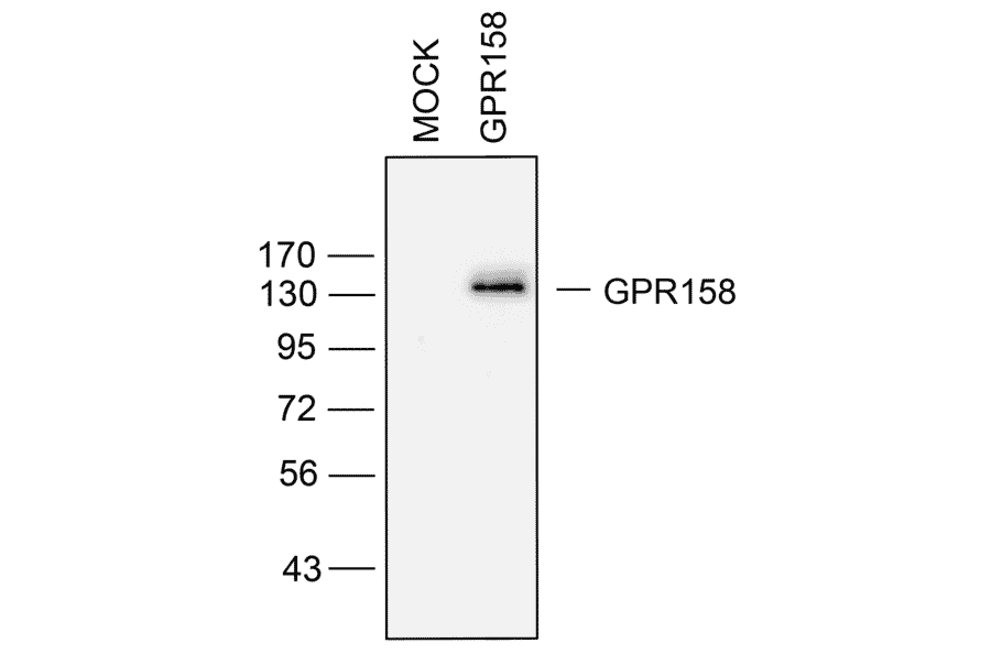Western blot - Anti-GPR158/mGlyR Antibody (A334524) - Antibodies.com