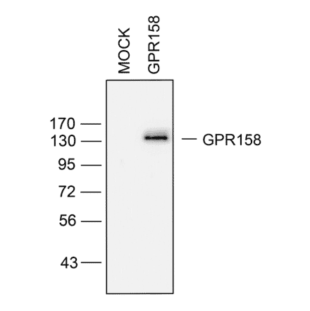 Western blot - Anti-GPR158/mGlyR Antibody (A334524) - Antibodies.com