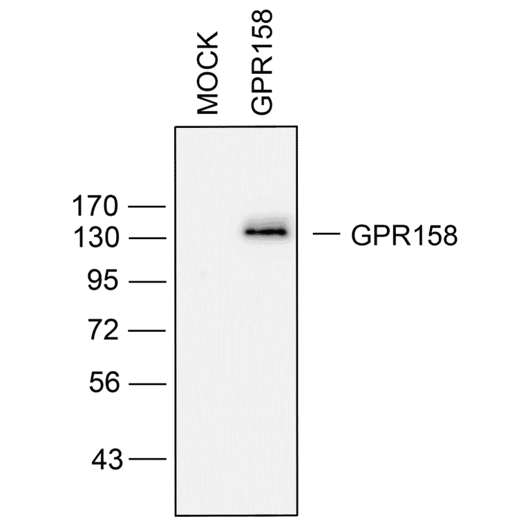 Western blot - Anti-GPR158/mGlyR Antibody (A334524) - Antibodies.com