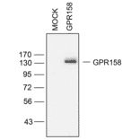 Western blot - Anti-GPR158/mGlyR Antibody (A334524) - Antibodies.com