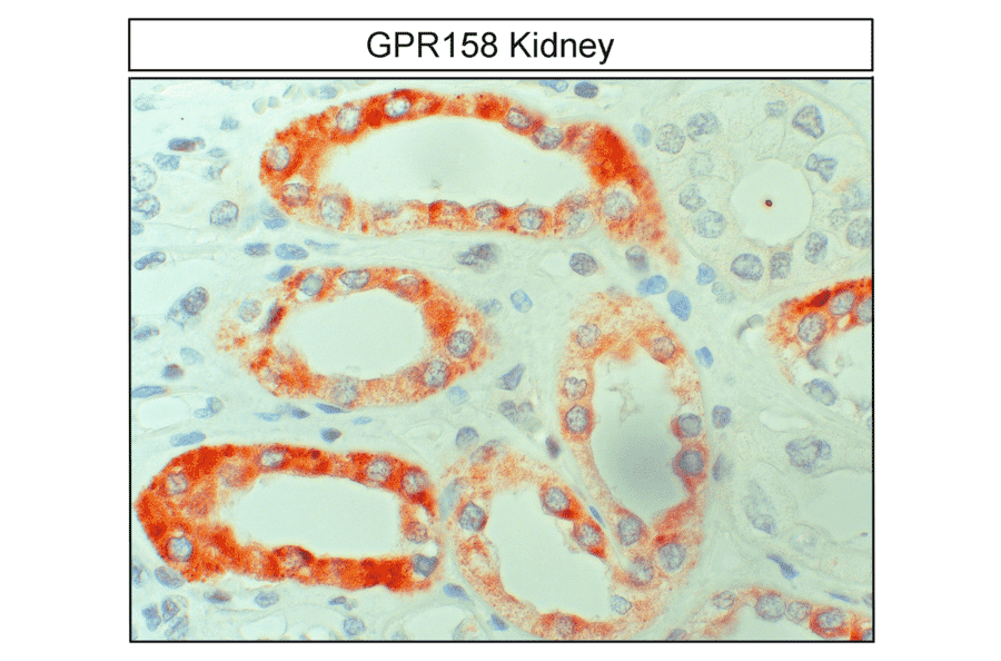 Immunohistochemistry - Anti-GPR158 Antibody (A334524) - Antibodies.com