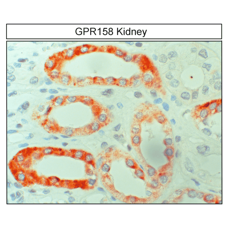Immunohistochemistry - Anti-GPR158 Antibody (A334524) - Antibodies.com
