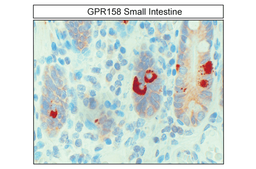 Immunohistochemistry - Anti-GPR158 Antibody (A334524) - Antibodies.com