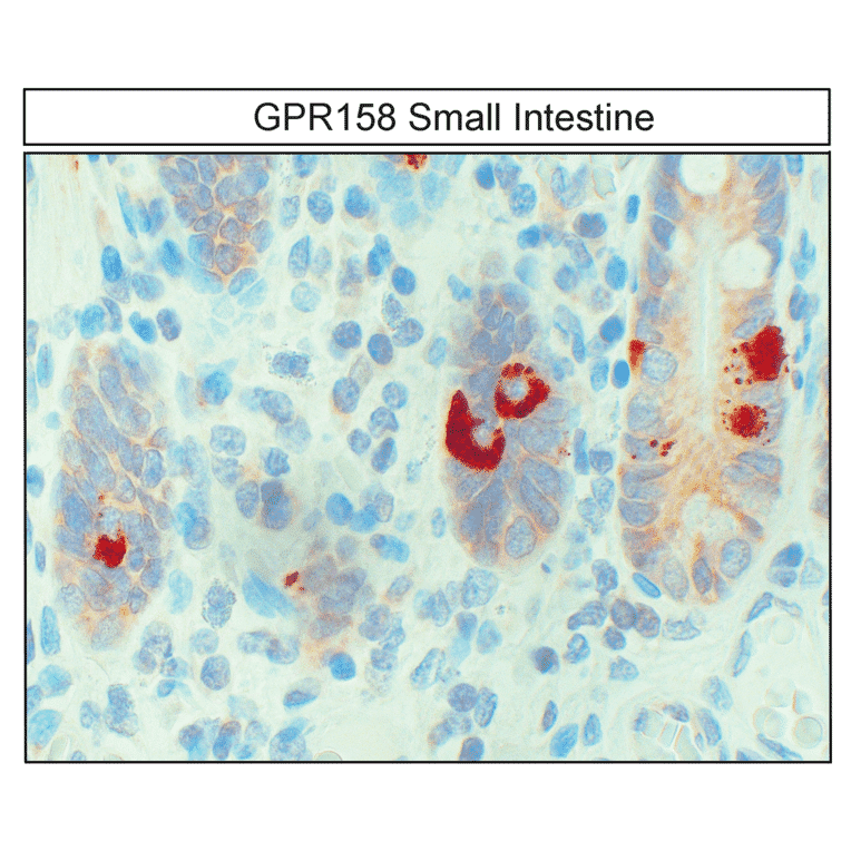 Immunohistochemistry - Anti-GPR158 Antibody (A334524) - Antibodies.com