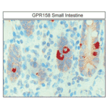 Immunohistochemistry - Anti-GPR158 Antibody (A334524) - Antibodies.com
