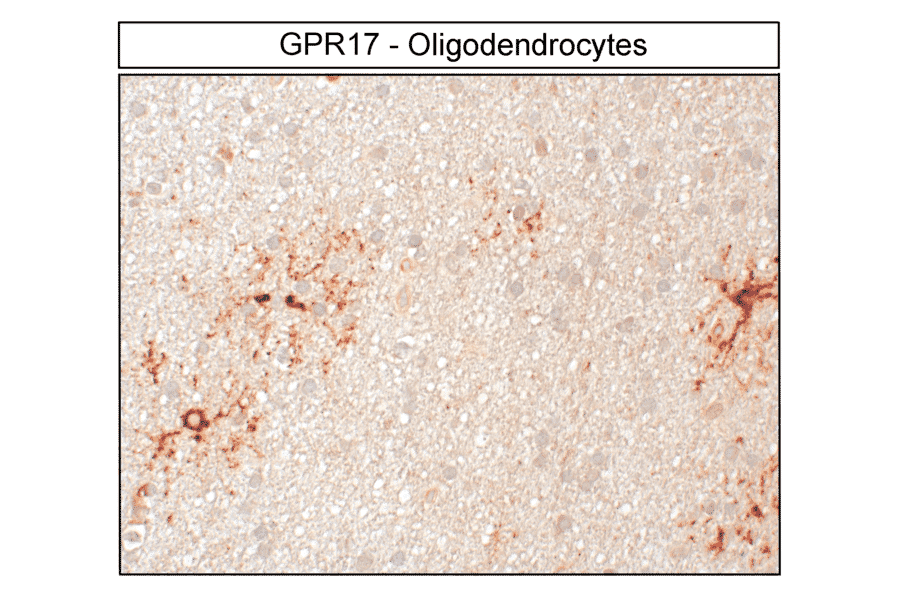 Immunohistochemistry - Anti-GPCR GPR17 Antibody (A334525) - Antibodies.com