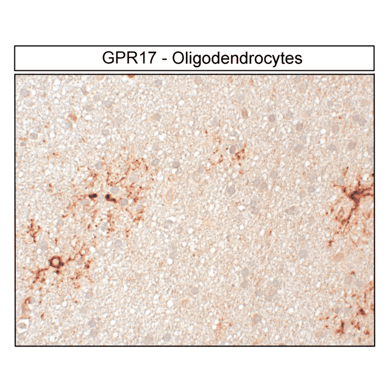 Immunohistochemistry - Anti-GPCR GPR17 Antibody (A334525) - Antibodies.com