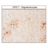Immunohistochemistry - Anti-GPCR GPR17 Antibody (A334525) - Antibodies.com
