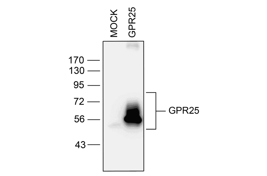 Western blot - Anti-GPCR GPR25 Antibody (A334527) - Antibodies.com