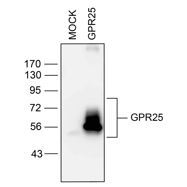 Western blot - Anti-GPCR GPR25 Antibody (A334527) - Antibodies.com