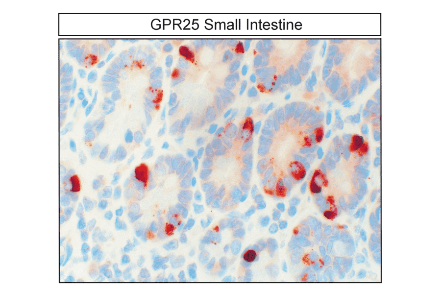 Immunohistochemistry - Anti-GPCR GPR25 Antibody (A334527) - Antibodies.com