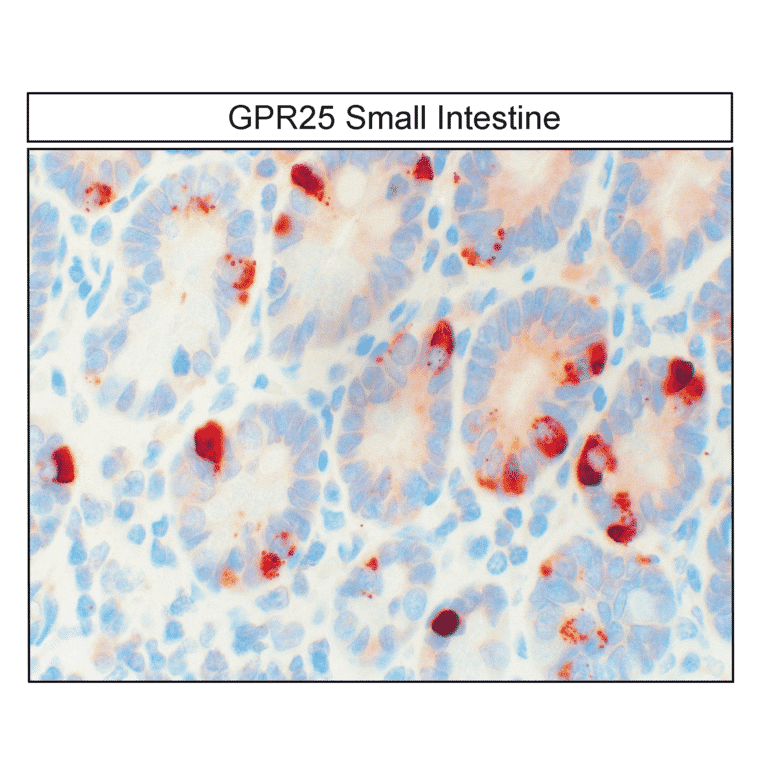 Immunohistochemistry - Anti-GPCR GPR25 Antibody (A334527) - Antibodies.com