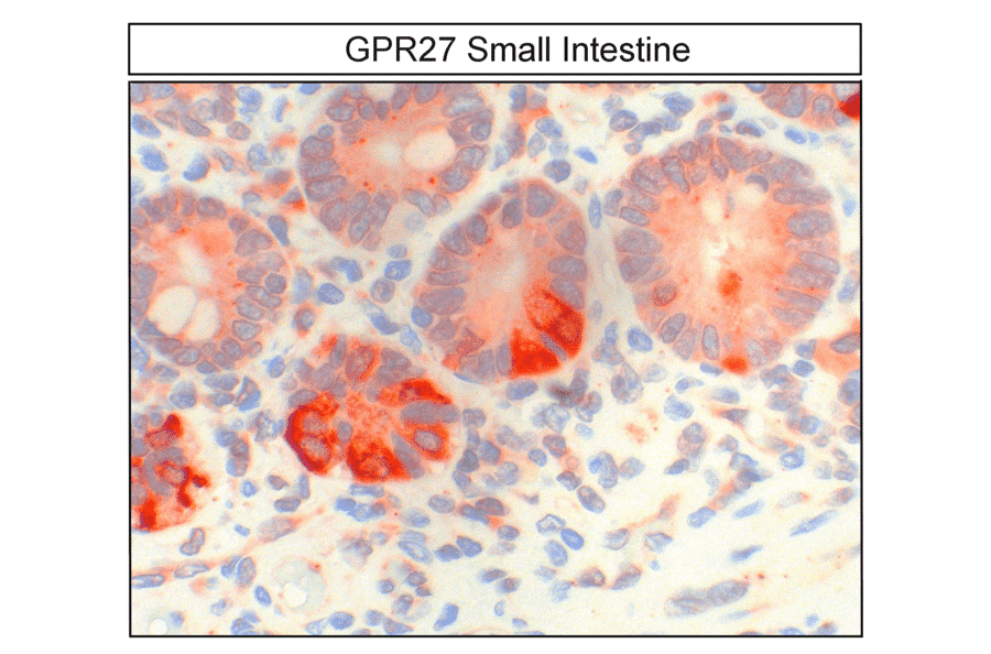 Immunohistochemistry - Anti-GPCR GPR27 Antibody (A334528) - Antibodies.com