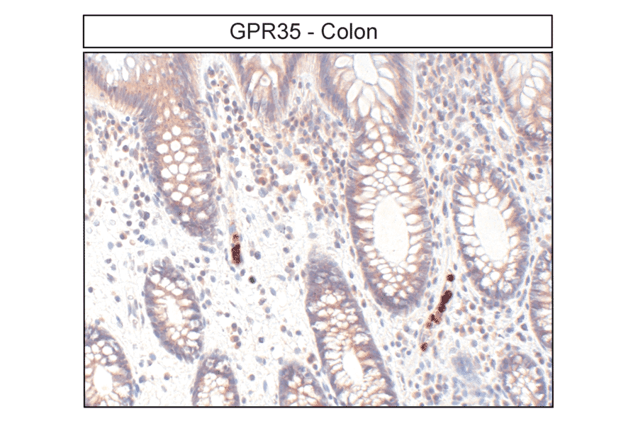 Immunohistochemistry - Anti-GPR35 Antibody (A334529) - Antibodies.com