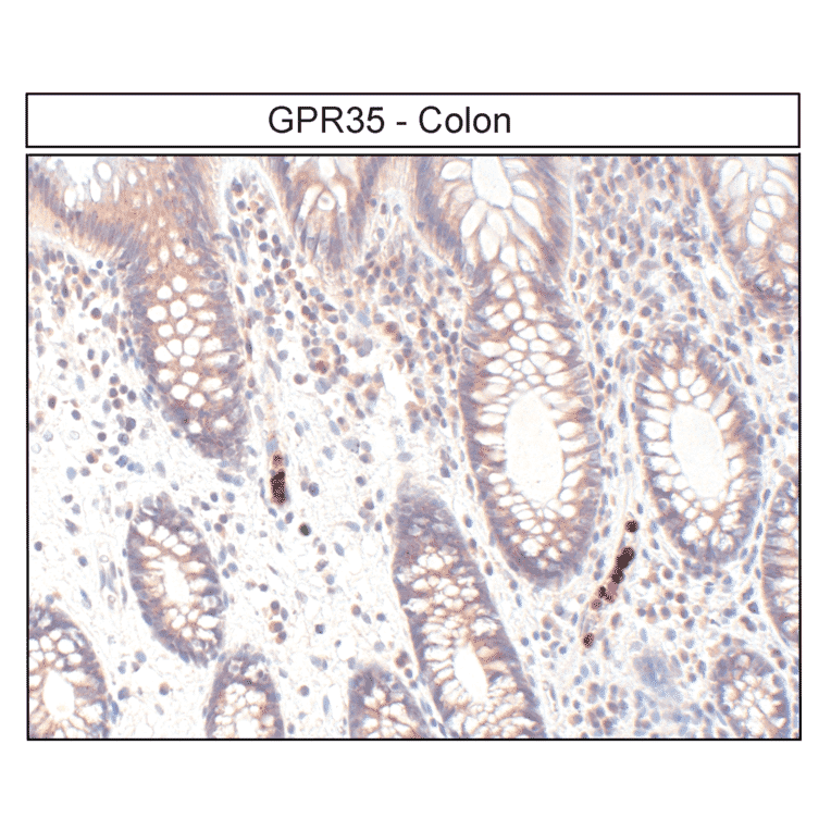 Immunohistochemistry - Anti-GPR35 Antibody (A334529) - Antibodies.com