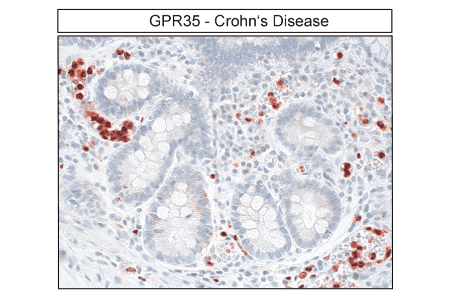 Immunohistochemistry - Anti-GPR35 Antibody (A334529) - Antibodies.com