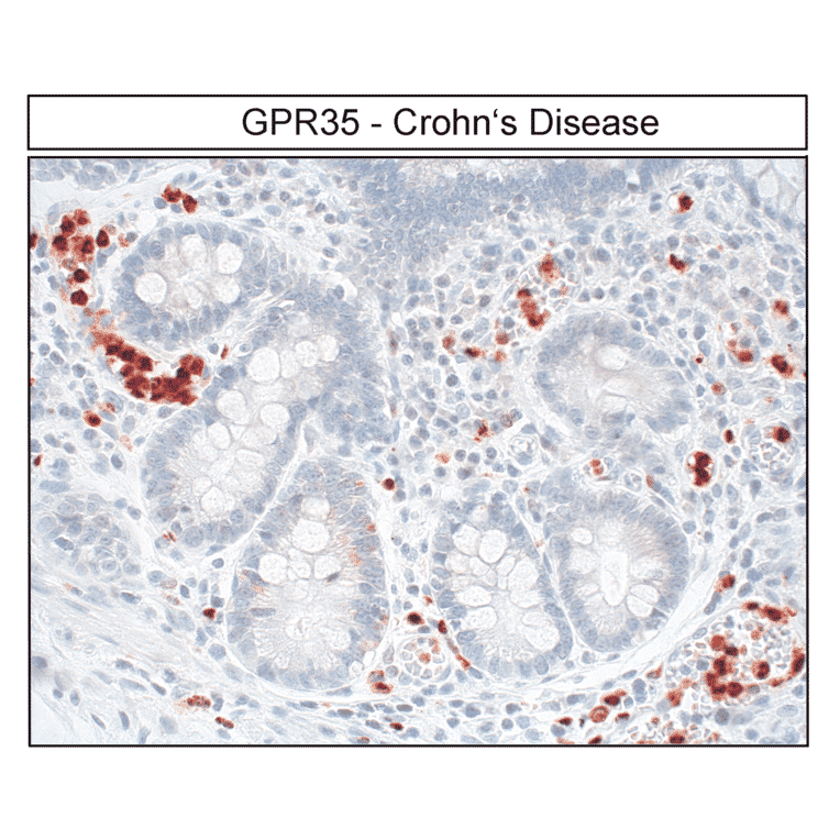 Immunohistochemistry - Anti-GPR35 Antibody (A334529) - Antibodies.com