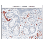 Immunohistochemistry - Anti-GPR35 Antibody (A334529) - Antibodies.com