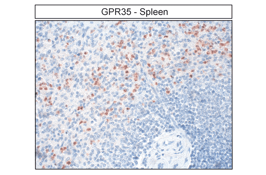 Immunohistochemistry - Anti-GPR35 Antibody (A334529) - Antibodies.com