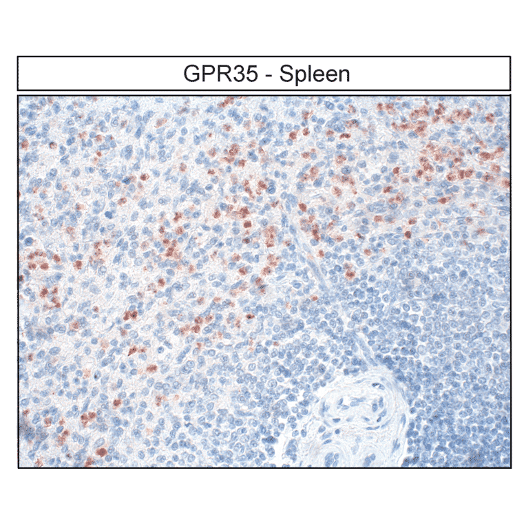 Immunohistochemistry - Anti-GPR35 Antibody (A334529) - Antibodies.com
