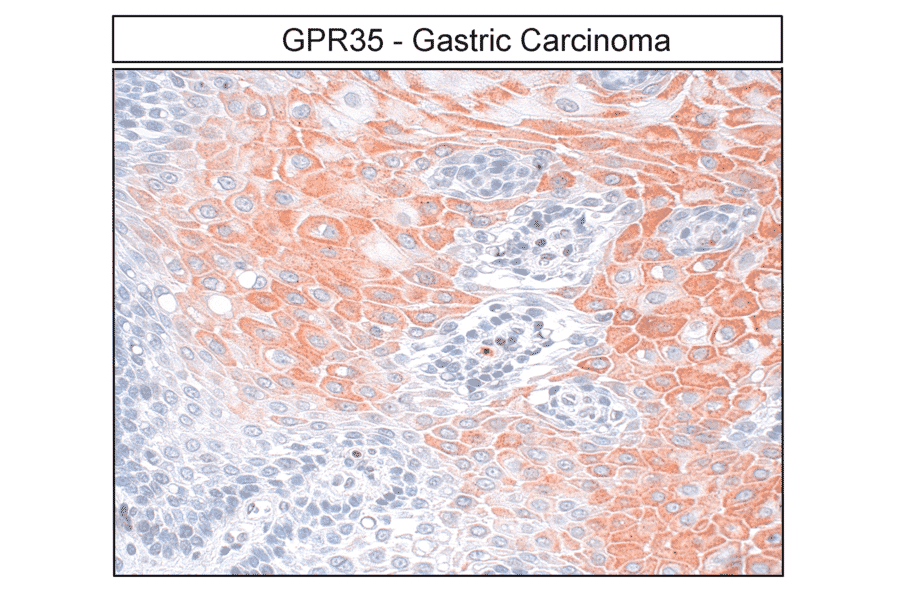 Immunohistochemistry - Anti-GPR35 Antibody (A334529) - Antibodies.com