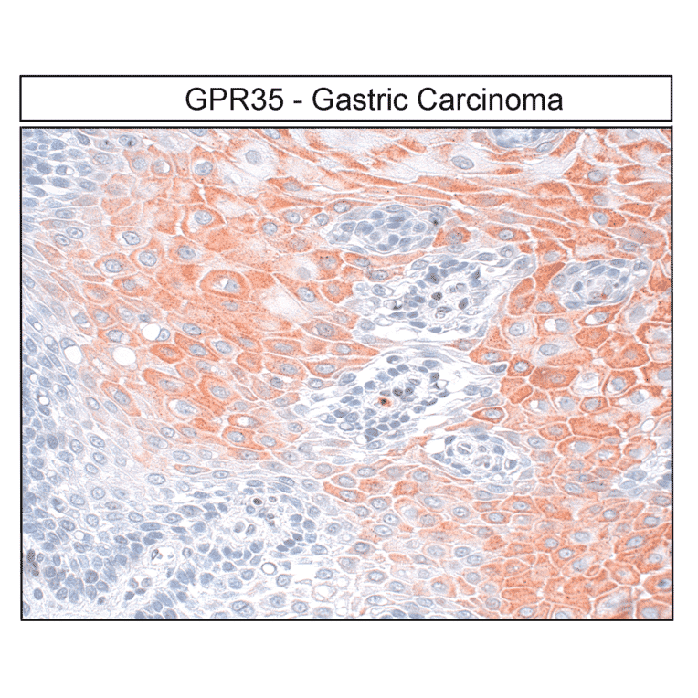 Immunohistochemistry - Anti-GPR35 Antibody (A334529) - Antibodies.com