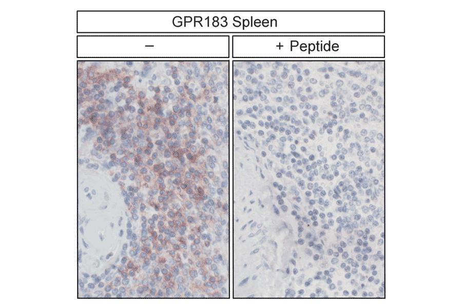 Immunohistochemistry - Anti-EBI2 Antibody (A334533) - Antibodies.com
