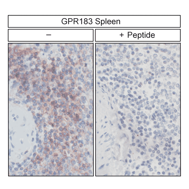 Immunohistochemistry - Anti-EBI2 Antibody (A334533) - Antibodies.com
