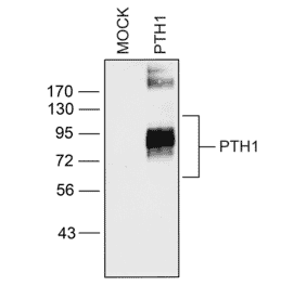 Western blot - Anti-PTH1R Antibody (A334534) - Antibodies.com