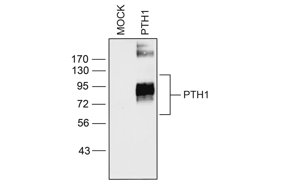 Western blot - Anti-PTH1R Antibody (A334534) - Antibodies.com