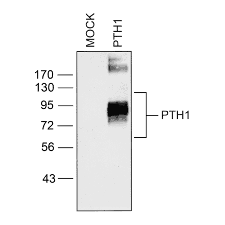 Western blot - Anti-PTH1R Antibody (A334534) - Antibodies.com