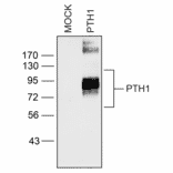 Western blot - Anti-PTH1R Antibody (A334534) - Antibodies.com
