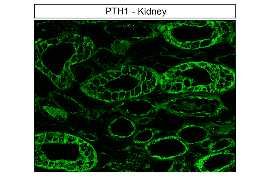 Immunohistochemistry - Anti-PTH1R Antibody (A334534) - Antibodies.com