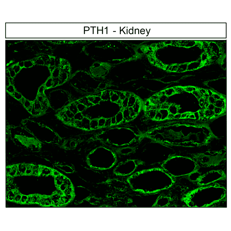 Immunohistochemistry - Anti-PTH1R Antibody (A334534) - Antibodies.com