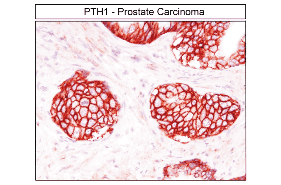 Immunohistochemistry - Anti-PTH1R Antibody (A334534) - Antibodies.com