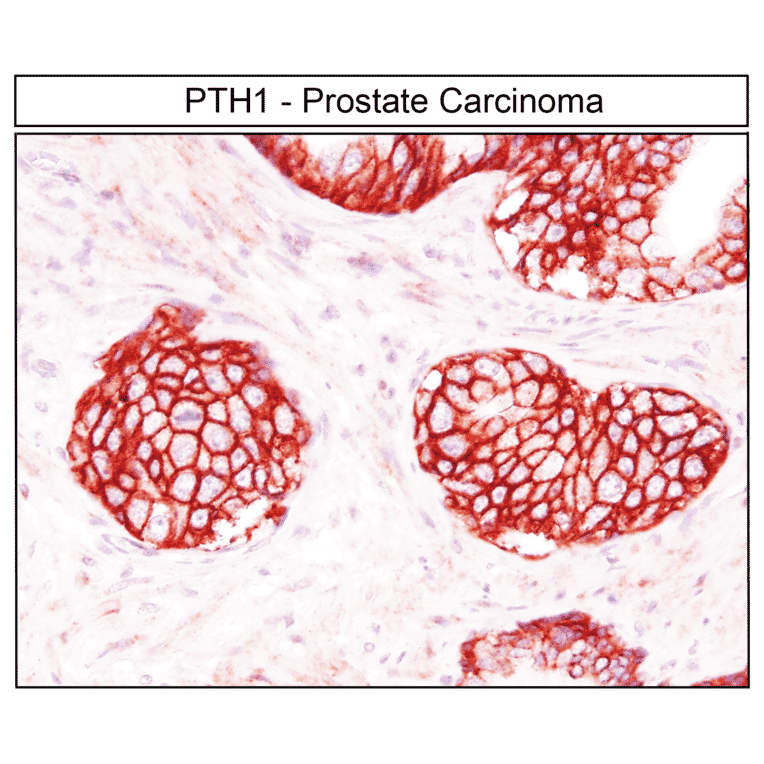 Immunohistochemistry - Anti-PTH1R Antibody (A334534) - Antibodies.com