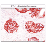 Immunohistochemistry - Anti-PTH1R Antibody (A334534) - Antibodies.com