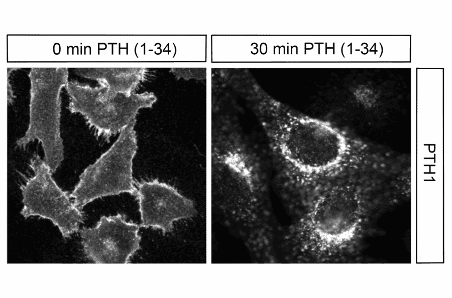 Immunohistochemistry - Anti-PTH1R Antibody (A334534) - Antibodies.com