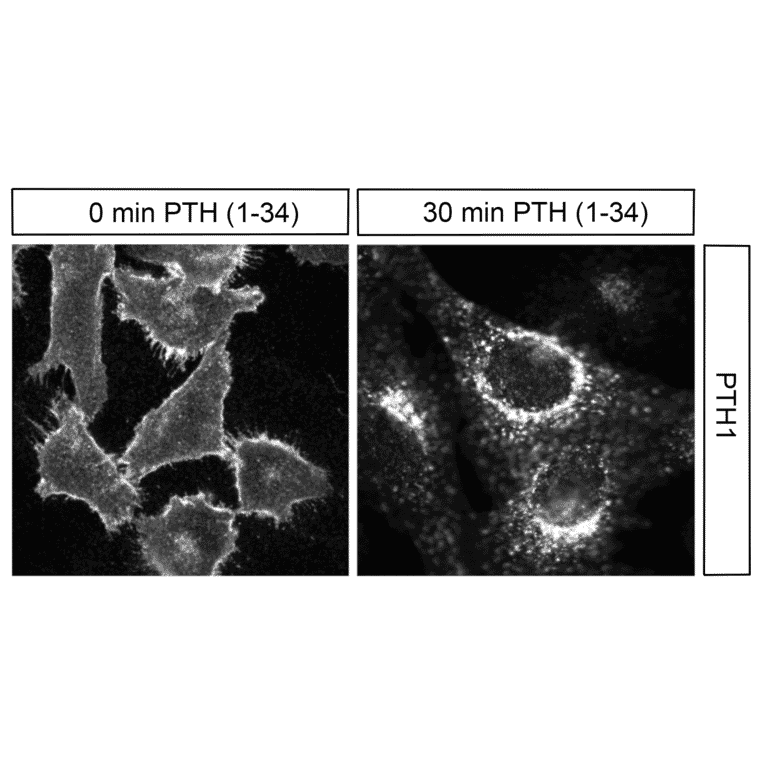 Immunohistochemistry - Anti-PTH1R Antibody (A334534) - Antibodies.com