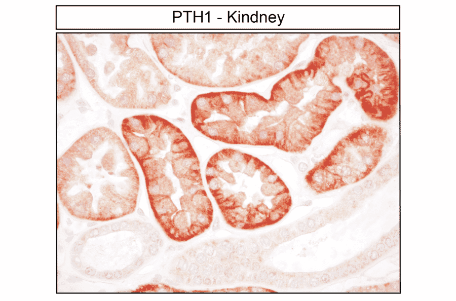 Immunohistochemistry - Anti-PTH1R Antibody (A334534) - Antibodies.com